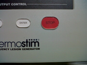 Thermostim Pain Management System